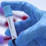 2,155 new Corona Cases and 55 deaths have been reported in the country Corona Virus Vaccine