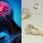 Karachi Claims Another Life to Brain-Eating Amoeba