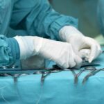 Concerns Arise After Patient’s Death in Islamabad Surgery surgery