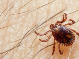 Congo Virus Claims 4 Lives in Khyber Pakhtunkhwa Region Conga Virus